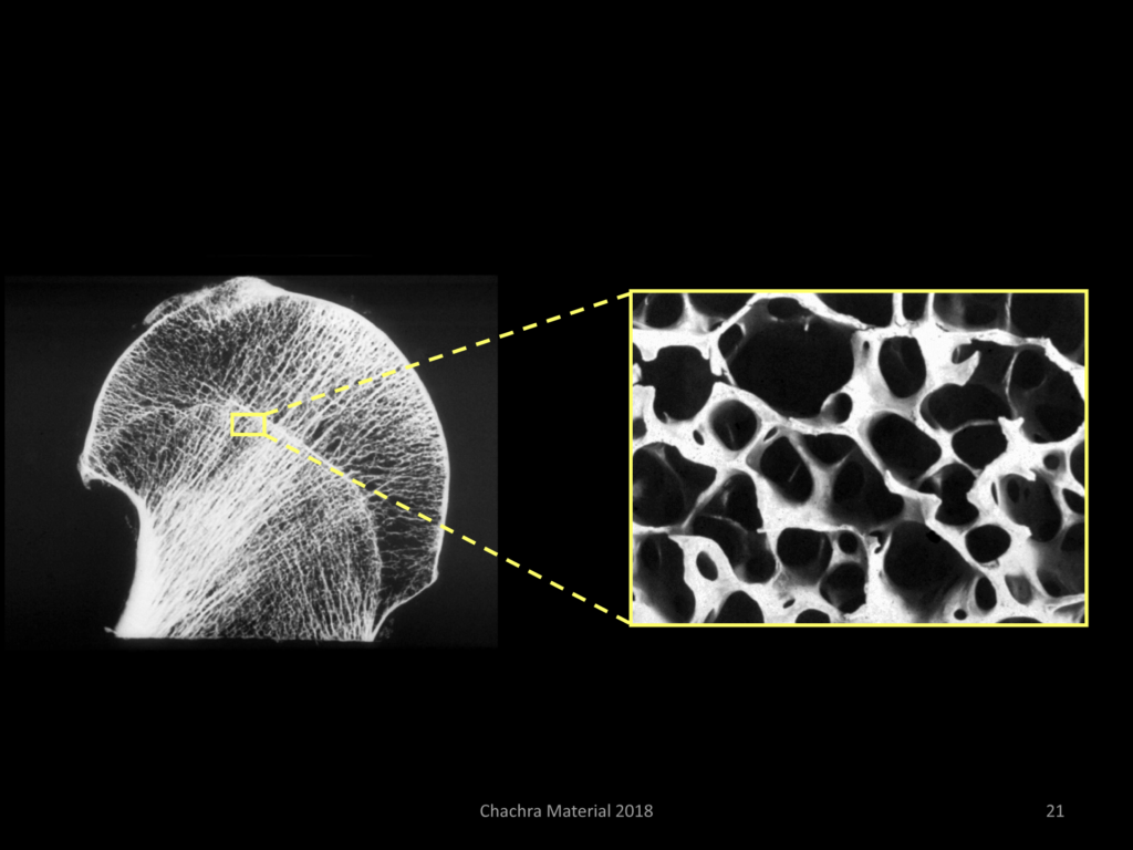 Magnified view of human bone